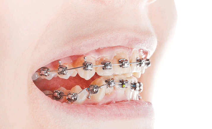 一般的な歯科医院の全顎矯正